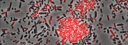 The micrograph shows the bacterium Photorhabdus luminescens. The cells labeled in red produce the aggregation factor. Credit: Ralf Heermann, LMU