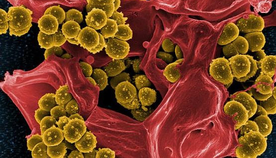 Methicillin-resistant Staphlyococcus aureus, or MRSA, is one of a growing number of drug resistant bacteria. Credit: NIAID