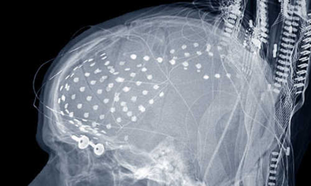Brain activity decoded to play back heard words