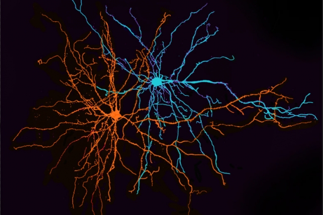 Two neurons of the basolateral amygdala. MIT neuroscientists have found that these neurons play a key role in separating information about positive and negative experiences.