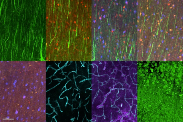 Labeling different proteins in a single tissue sample offers a new way to classify neurons and other cells. On the top row, pyramidal neurons are shown in green, and different types of inhibitory interneurons are labeled red, blue, and orange. In the bottom row, at far left, interneurons only are labeled. The two middle images show blood vessels in cyan, and astrocytes in purple. At far right, every neuron in the sample is labeled green. 