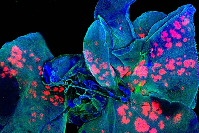 A new report, “Convergence: The Future of Health,” draws on insights from scientists and researchers across academia, industry, and government. The cover of the report is an image of lungs, one of the major sites of metastasis. To help protect the lungs (blue) from this deadly process, bioengineers have created microscopic drug depots (red) to focus the effect of anti-cancer drugs that may have limited or toxic effects when delivered to the whole body