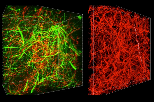 A new technique called magnified analysis of proteome (MAP), developed at MIT, allows researchers to peer at molecules within cells or take a wider view of the long-range connections between neurons.  