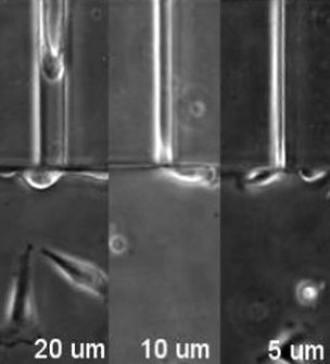 This is a time-lapse microscopy movie of human breast cancer cells migrating into channels of different widths (20um, 10um and 5um). The far left panel show scells moving easily into channels that are 20um wide. The central panel shows that cells take longer to migrate into the smaller 10um size channels. The far right panel shows cells are unable to migrate into 5um wide panels and protrude their cytoplasm into the channel, but the nuclei remain outside the channel. This indicates that the size and deformability of the cell nuclei acts as a limiting factor for cells to squeeze into small spaces. Credit: Jayo et al.