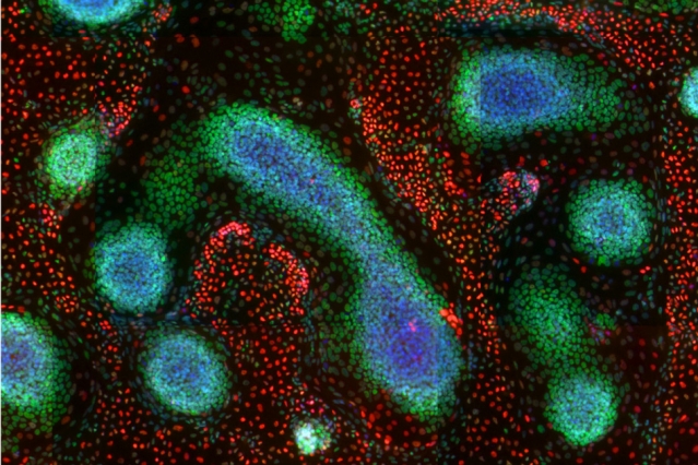 This image demonstrates tissue patterns that emerge from genetically programmed human pluripotent stem cells, and was taken on day nine of the MIT study. It shows immunostainings of cell nuclei for CEBPA (red, endodermal marker), SOX10 (green, ectodermal marker), and DAPI (blue, binds to DNA in the nucleus). 