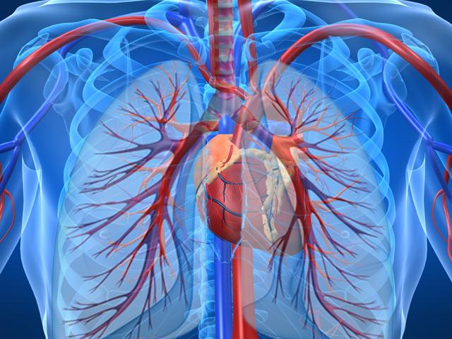 Pulmonary Hypertension