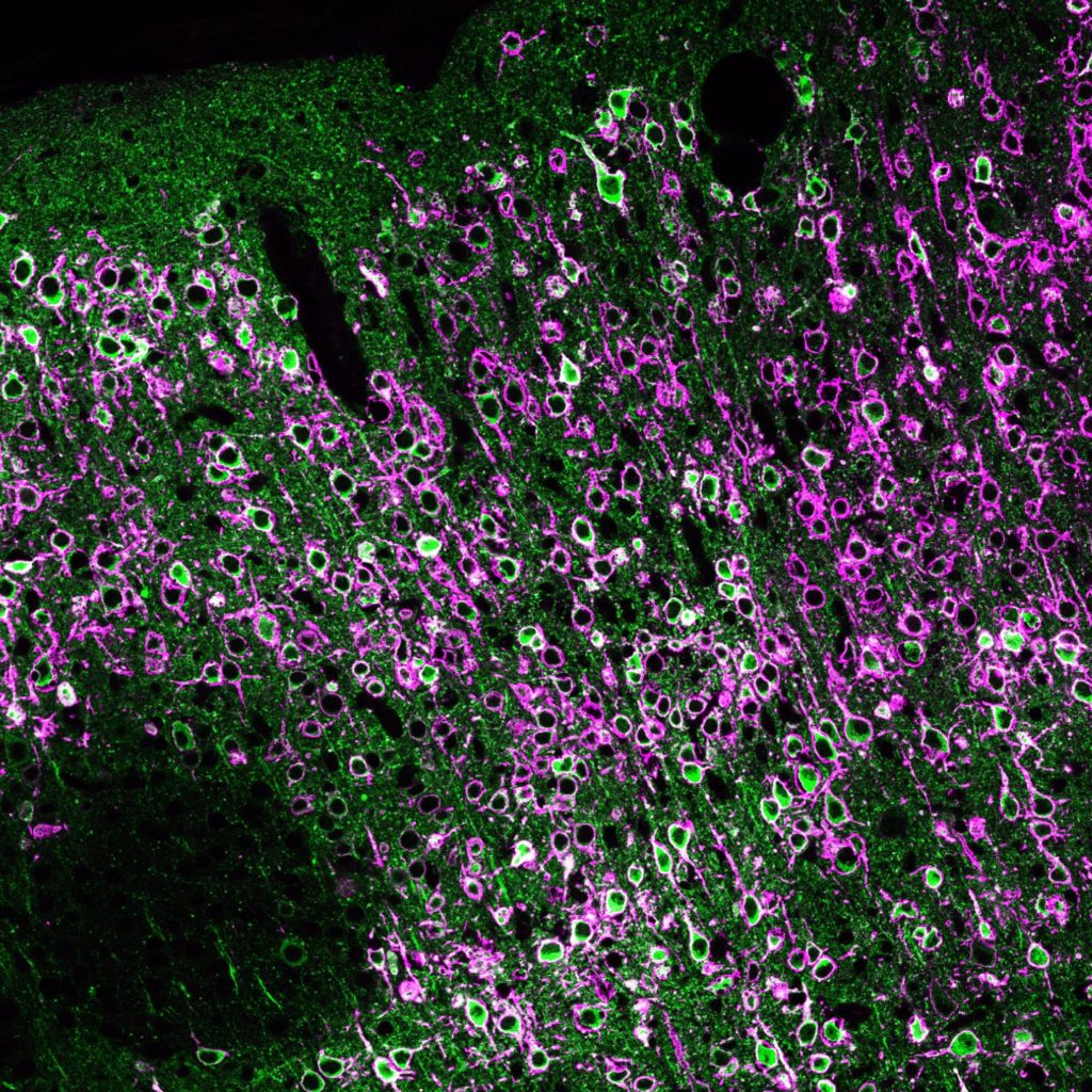 Refining optogenetic methods to map synaptic connections in the brain