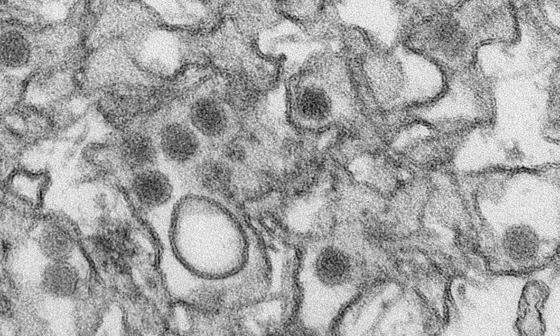 Transmission electron micrograph (TEM) of Zika virus. Credit: Cynthia Goldsmith/Centers for Disease Control and Prevention