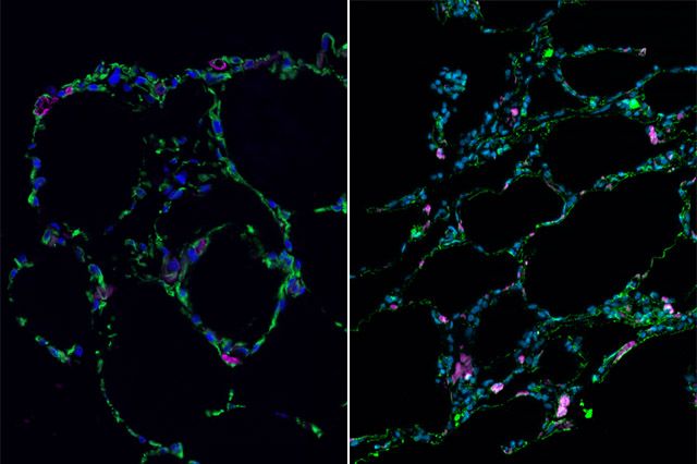 Credits: UCLA Broad Stem Cell Research Center 3-D bioengineered lung-like tissue (left) resembles adult human lung (right).