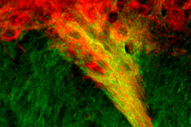 MIT neuroscientists have identified tight connections between dopamine-producing cells of the substantia nigra (red) and neurons in the striatum (green). These connections, which show up as yellow, may play a role in the brain’s decision-making processes.  