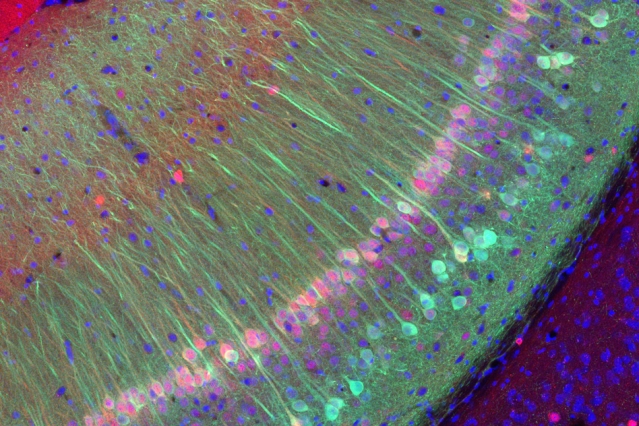 MIT neuroscientists have identified neurons that are responsible for storing memories of familiar individuals. These cells, labeled green, are located in a region of the hippocampus known as the vCA1. 