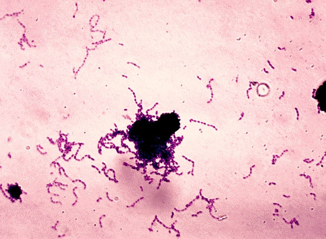 Streptococcus Bacteria Credit: Wikimedia