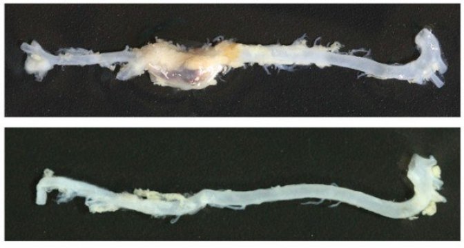 The aorta of a mouse fed a normal diet shows a large aneurysm (top), whereas an aorta from a mouse fed a calorie-restricted diet shows no abnormal dilations (bottom). Credit: Liu et al., 2016