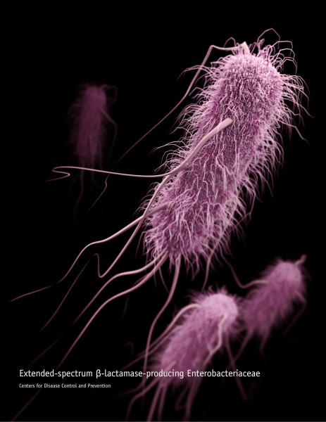 Extended-spectrum ß-lactamase-producing bacteria (ESBL) come from a strain of E. coli and are resistant to several types of antibiotics, severely limiting treatment options. Credit: James Archer/CDC