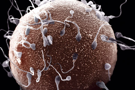 Mutations in the RHOX transcription factor family inhibit sperm development and are associated with infertility in men. Credit:  University of California San Diego Health Sciences. 