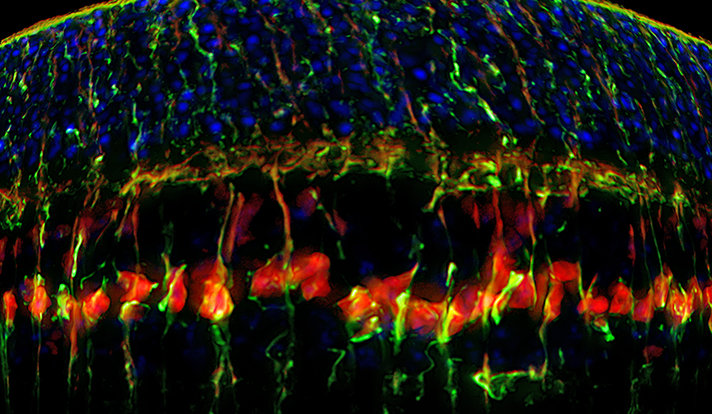 This image shows how transferred genes activate the stem cell properties of normally dormant retinal cells. Credit: Image courtesy of Yale University