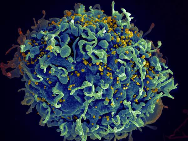 HIV, the AIDS virus (yellow), infecting a human immune cell. Credit: Seth Pincus, Elizabeth Fischer and Austin Athman, National Institute of Allergy and Infectious Diseases, National Institutes of Health.