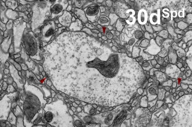 Electron micrographs revealed the alignment of the plasma membrane, with evident increase in extracellular spacing between cellular elements, to be affected in 30d w1118 flies, when compared to 3d or 30dSpd w1118 flies. Credit: Gupta VK, Pech U, Bhukel A, Fulterer A, Ender A, Mauermann SF, et al.; Creative Commons Attribution License