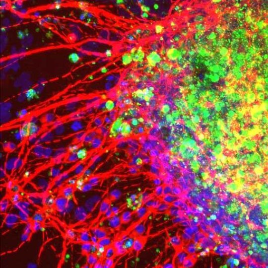 This image shows neural stem cells after being treated with LIF signaling molecules, 20x. Credit: Rachel Greenberg