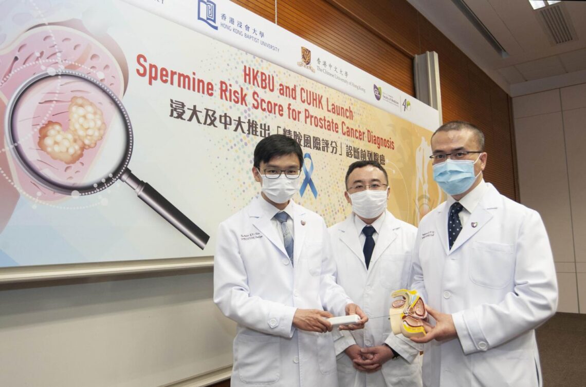 HKBU and CUHK launch Spermine Risk Score for prostate cancer ...