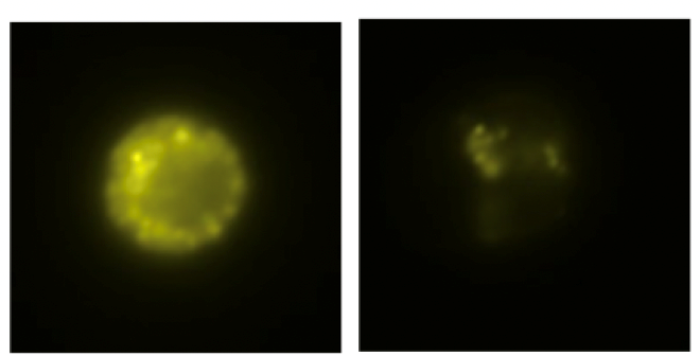 isolated mast cell progenitor before and after IgE-crosslinking