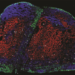 Resident memory T cells in lymph node.