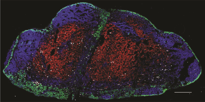 Resident memory T cells in lymph node.