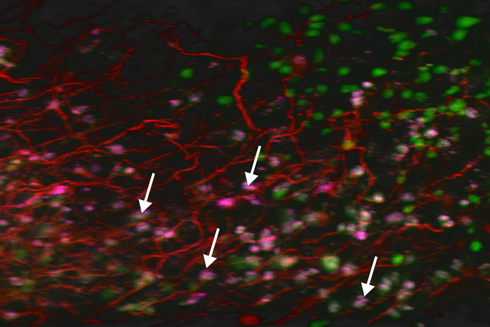 $7.5 million to study elusive cell type important in aging, cancer, other diseases