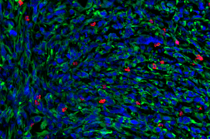 Immunofluorescence image of a tumor