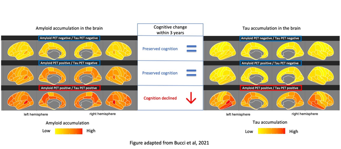 Brain imaging, Alzheimer's disease