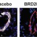 Rodent blood vessels treated with placebo or BRD2889.