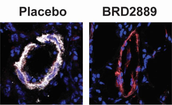 Rodent blood vessels treated with placebo or BRD2889.