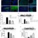 Role of KYP-2047 treatment on apoptosis Immunofluorescence staining for Caspase-3 was performed to examine apoptosis in the lungs