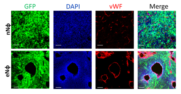 Bone marrow pro-tumorigenic neutrophils (lower panel) promote the formation of new blood vessels (angiogenesis) in the tumor. GFP (green) = tumor, vWF (marker for blood vessels).
