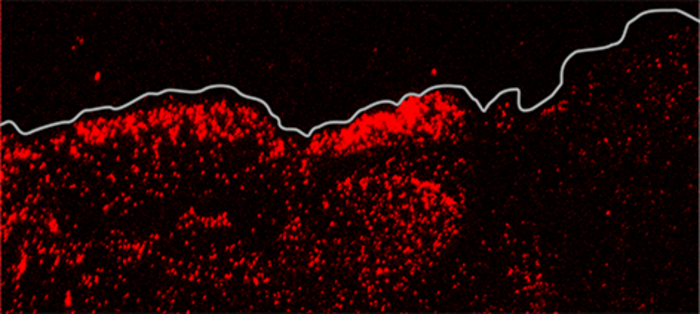 PIEZO1 in wound healing