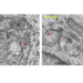 Transmission electron microscopy images