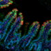 Image demonstrating TNF-driven intestinal inflammation, where the gut-lining epithelial cells