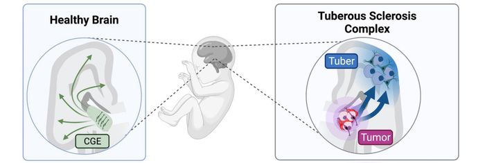 Origin and role of CLIP cells in Tuberous Sclerosis