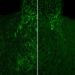 4EPS affects myelin production in the mouse brain