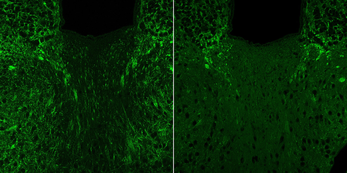 4EPS affects myelin production in the mouse brain