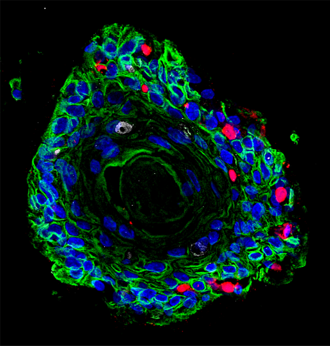 Ectocervical Organoid