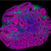 Brain organoid showing different cell types