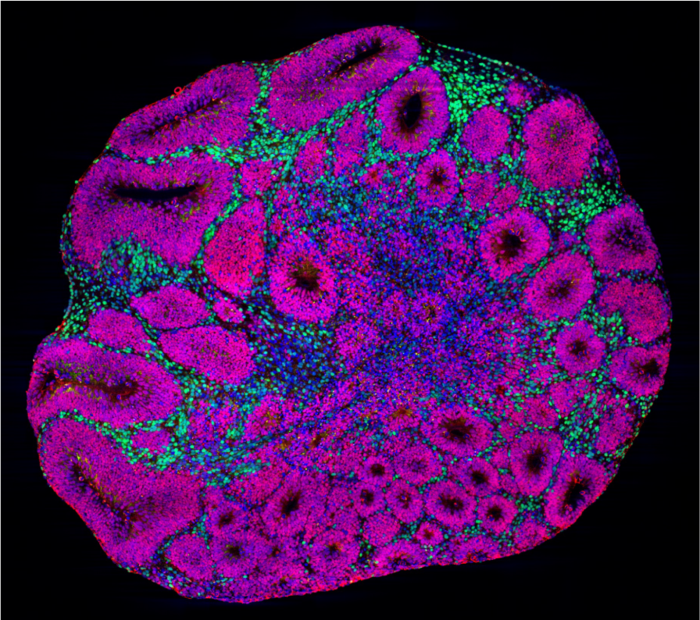 Brain organoid showing different cell types