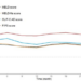 Model Performance for Mortality Prediction Post-TIPS Placement