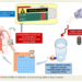 Salt in soluble paracetamol linked to increase risk of cardiovascular disease and death