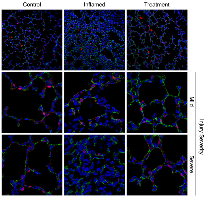 How Anti-Inflammatories Can Protect Developing Lungs From Infection Damage