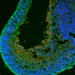 Cross-section of a retinal organoid used in the study