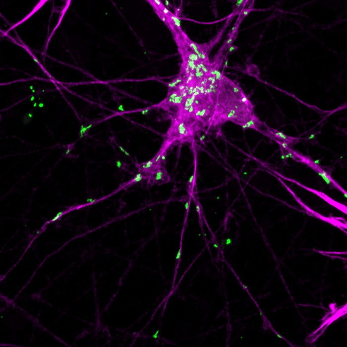 Shining a light on protein aggregation in Parkinson’s disease