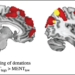 Stress Hormone Reduces Altruistic Behavior in Empathetic People