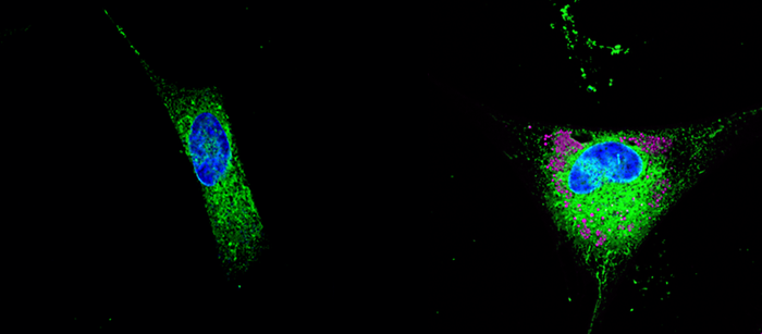 The role of lipids in the development of Alzheimer’s disease